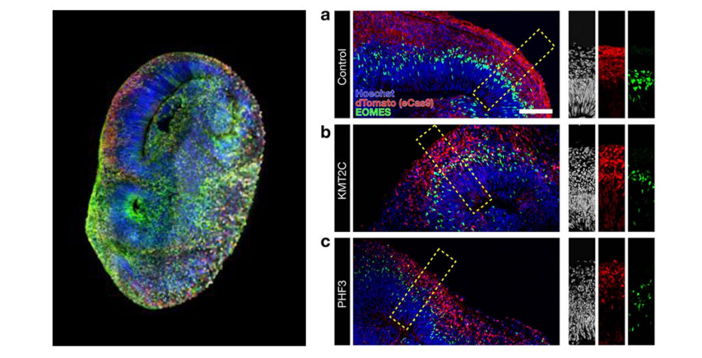 Gauche ©Knoblich Lab / IMBA-IMP Graphics I Extrait article Sept. 2023, GENImage confocale d'un système de mosaïque organoïde de cerveau humain CHOOSE (CRISPR-human organoids-scRNA-seq) montrant des cellules porteuses d'une mutation en rouge. Moitié droite : une représentation en mosaïque de différentes couleurs représentant des cellules individuelles, chacune portant une mutation dans un gène de l'autisme de haute fiabilité. Droite © Li, C., Fleck, J.S., Martins-Costa, C. et al. Single-cell brain organoid screening identifies developmental defects in autism. Nature 621 a-c, images confocales montrant une coloration immunohistochimique sur des organoïdes âgés de 60 jours perturbés par des gènes individuels. dTomato marque les cellules induites par eCas9. 
