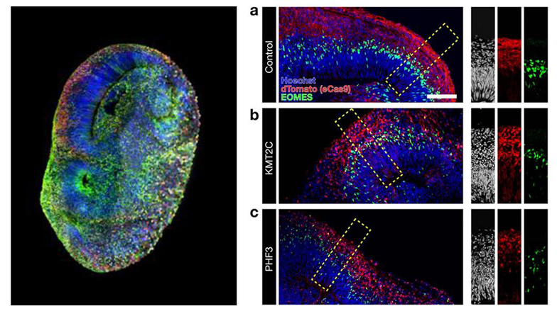 Crédit: Knoblich Lab / IMBA-IMP Graphics / Li, C., Fleck, J.S., Martins-Costa, C. et al